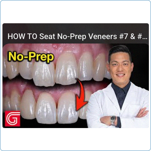 Case Videos