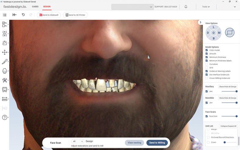 Scan Align (Close-Up)