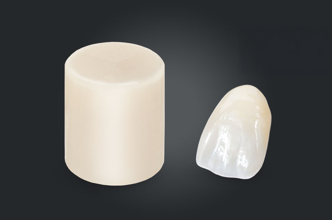 BruxZir Esthetic NOW - Anterior