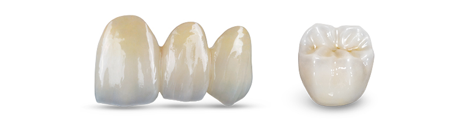 BruxZir Restorations