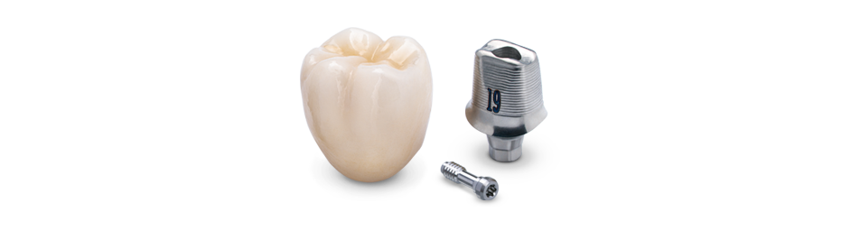 Custom Abutments and Implant Crowns