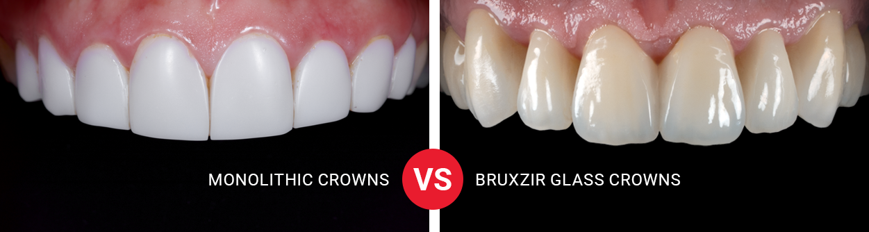 crowns that look like teeth