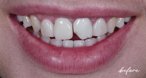 Clinical study- case 1 before