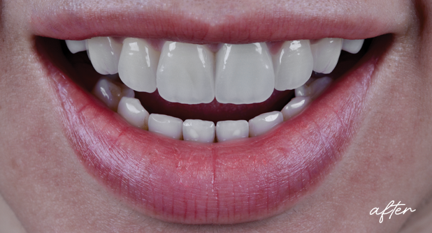 Clinical study- case 1 after