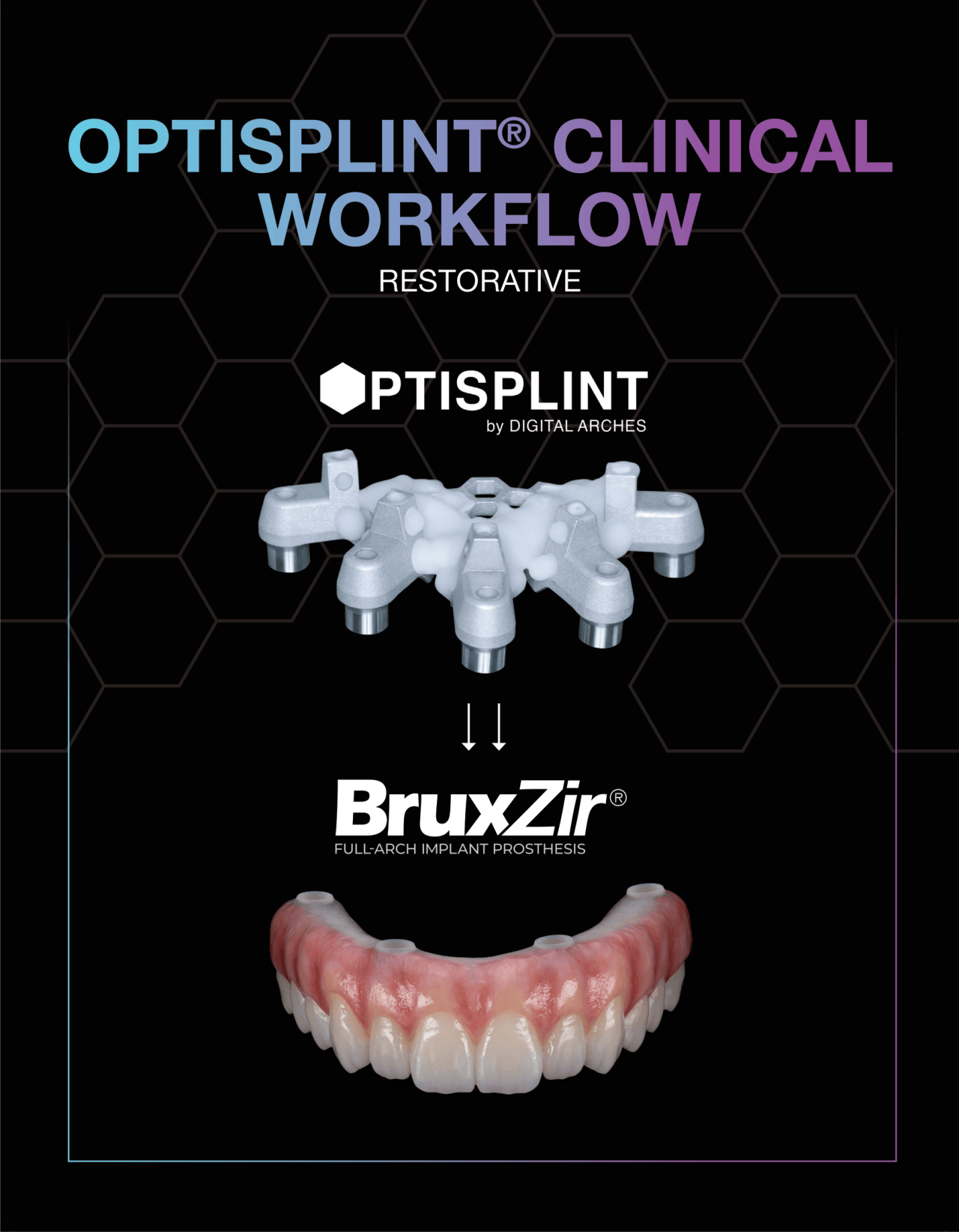 OptiSplint Clinical Workflow - Restorative Thumbnail