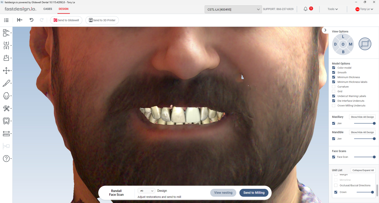 fastsmile.io™ 3D Facial Scanner Align