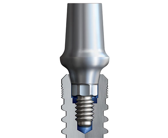Conical prosthetic connection