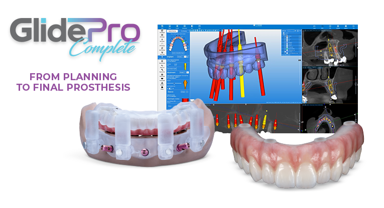 glidepro_complete