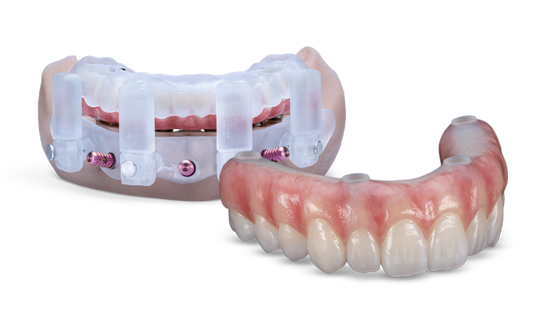 GlidePRO Stackable Surgical Guides