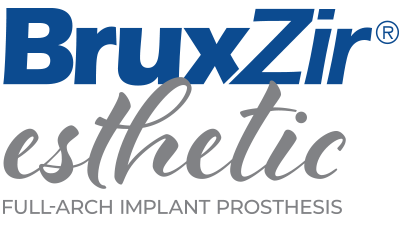 BruxZir Esthetic Full-Arch Implant Prosthesis