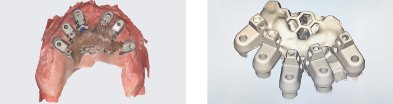 Scanning the Splinted Structure