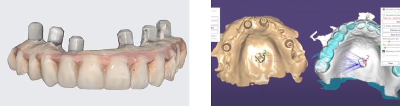  Recording Tooth Positioning