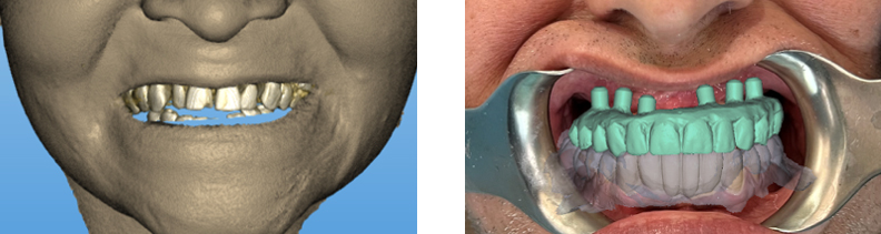 Facial Record 