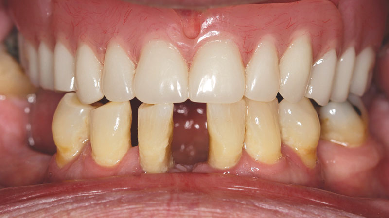 Clinical study- case 1 after