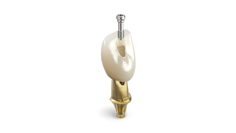 Screwmentable Crowns Signature Image