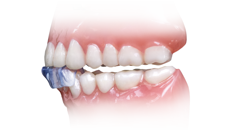 NTI-tss Plus Product Page Signature Image