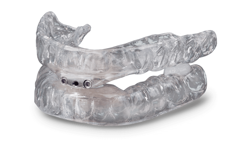 How to Stop Snoring? TAP® 3 TL - Stop Snoring Devices